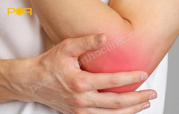 روشهای تشخیص سندروم کوبیتال