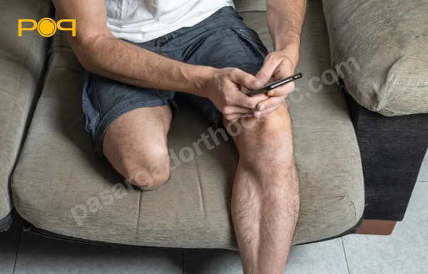 قطع عضو یا آمپوتاسیون