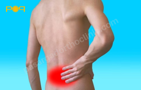 اسپوندیلیت آنکیلوزان علت خار پاشنه